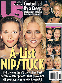 Illustration for article titled Today In Tabloids: Scarlett's Nose, Shiloh's Whereabouts, Britney's Fetus